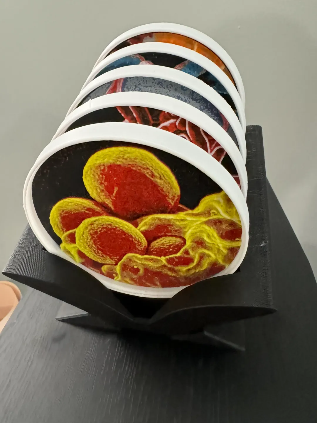 Bad Bugs- Disease Causing Bacteria